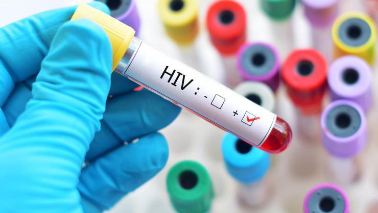 Hıv Fobisi AIDS korkusu nedir?