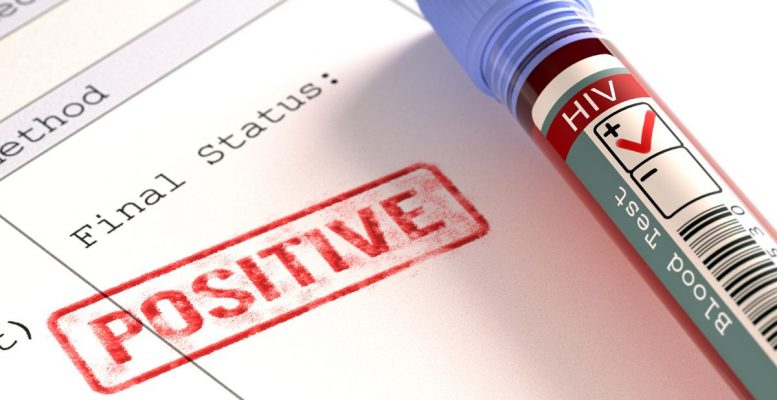 HIV Fobisi Neden Olur?